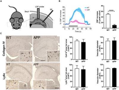 Impaired Hippocampal Neurovascular Coupling in a Mouse Model of Alzheimer’s Disease